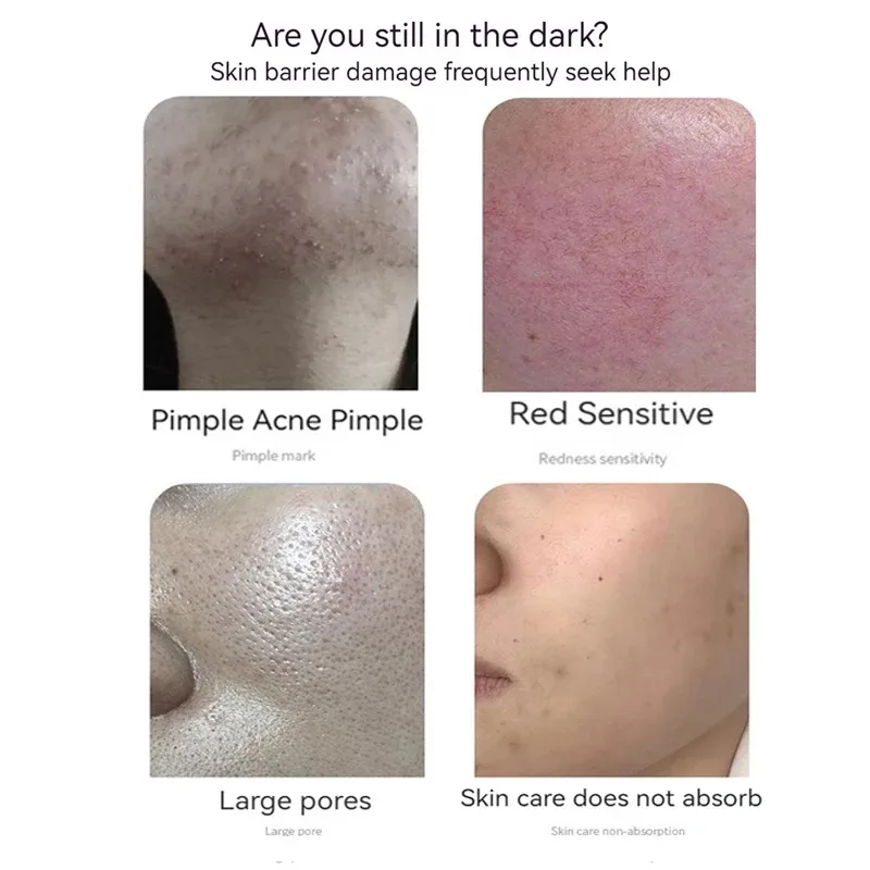 青銅ペプチド凍結乾燥パウダーセットオリゴペプチド抗しわエッセ - Oligopeptide Wrinkle のレビューと価格