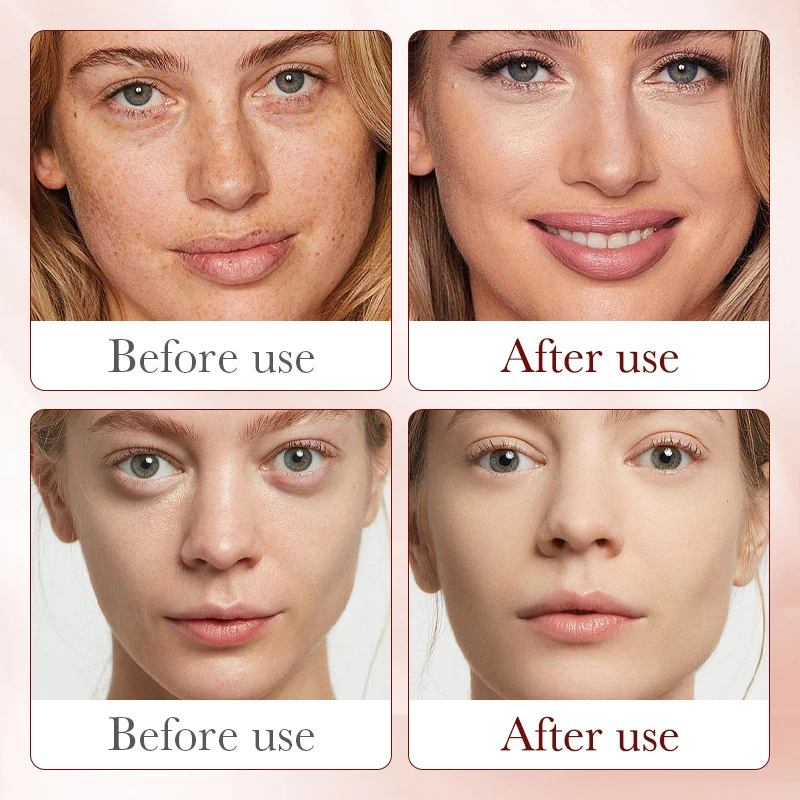 ロイヤルドラゴン-保湿血清,フェイシャルケア,交換,肌の若返 - Placenta Extract Serum のレビューと価格